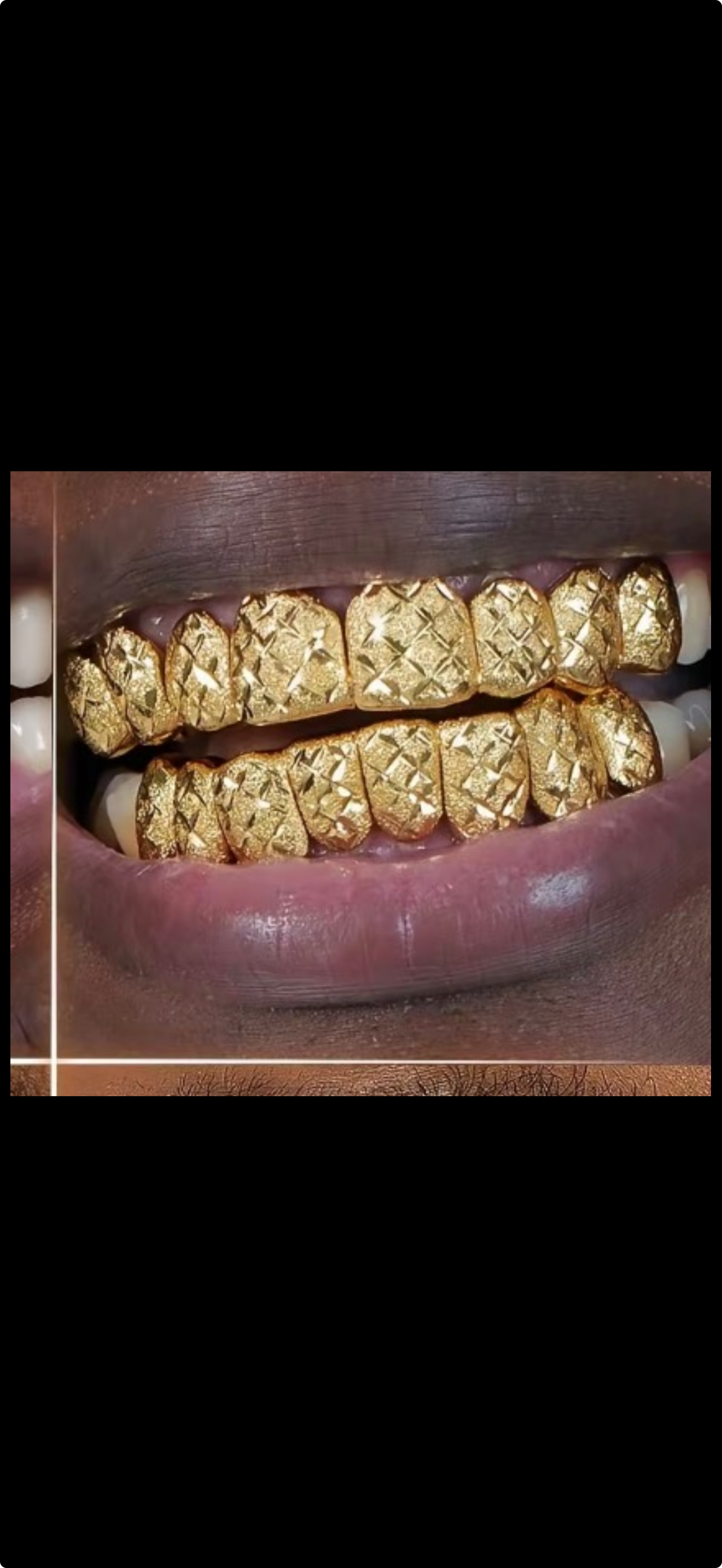 10K GOLD GRILLZ 8 TOP & 8 BOTTOM DIAMOND CUT WITH DIAMOND DUST