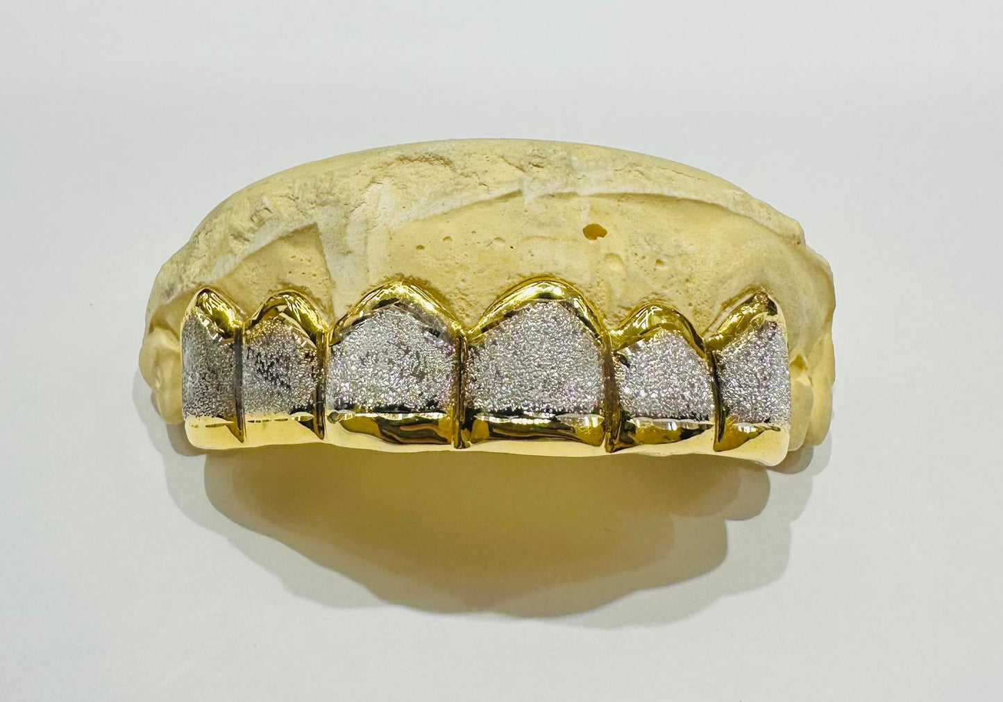 10K TWO TONED DIAMOND DUST GRILL (6PC: $599) - ( AVAILABLE IN 6PC, 8PC, 10PC, 12PC)