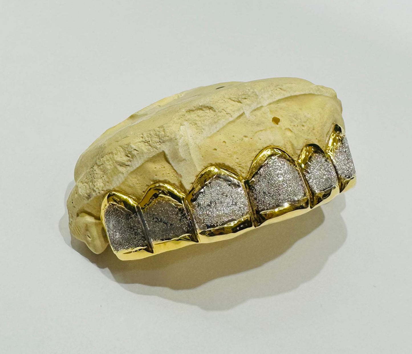 10K TWO TONED DIAMOND DUST GRILL (6PC: $599) - ( AVAILABLE IN 6PC, 8PC, 10PC, 12PC)