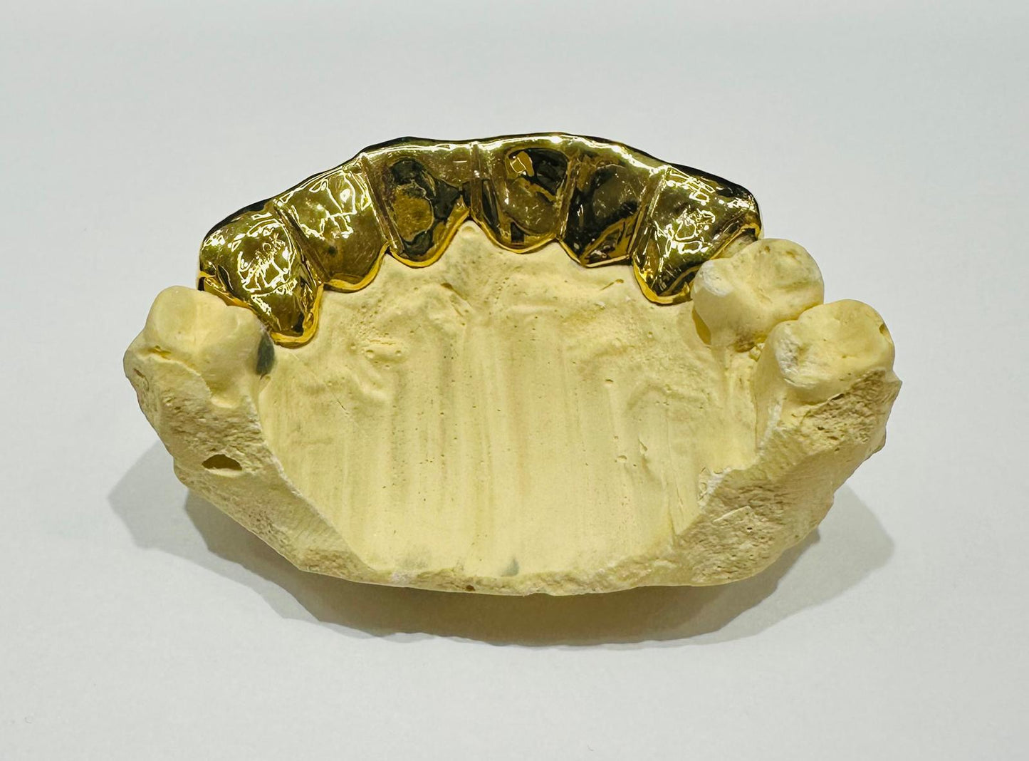 10K TWO TONED DIAMOND DUST GRILL (6PC: $599) - ( AVAILABLE IN 6PC, 8PC, 10PC, 12PC)