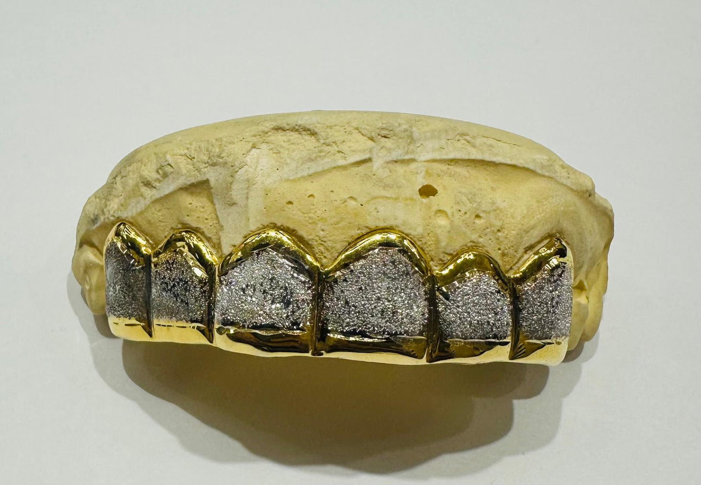 10K TWO TONED DIAMOND DUST GRILL (6PC: $599) - ( AVAILABLE IN 6PC, 8PC, 10PC, 12PC)