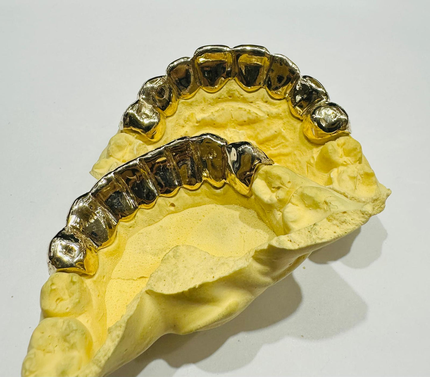 10K GOLD SUNBURST DIAMOND CUT PULLOUT GRILL (8 TOP & BOTTOM : $1599) -( AVAILABLE IN 6PC, 8PC, 10PC, 12PC)