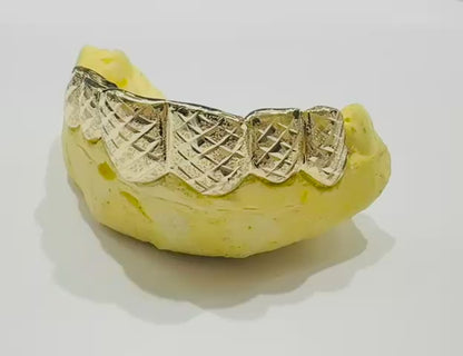10K GOLD DIAMOND CUT DIAMOND DUST PULLOUT GRILL (6 BOTTOM : $599) -( AVAILABLE IN 6PC, 8PC, 10PC, 12PC)